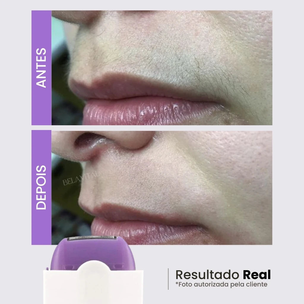 Depilador Laser Indolor 2 em 1 - DepilFlex