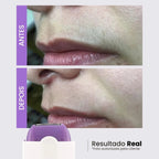 Depilador Laser Indolor 2 em 1 - DepilFlex